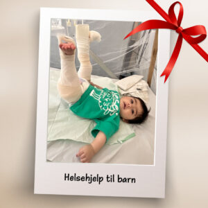 Barn med gips på bena ligger i sykehusseng